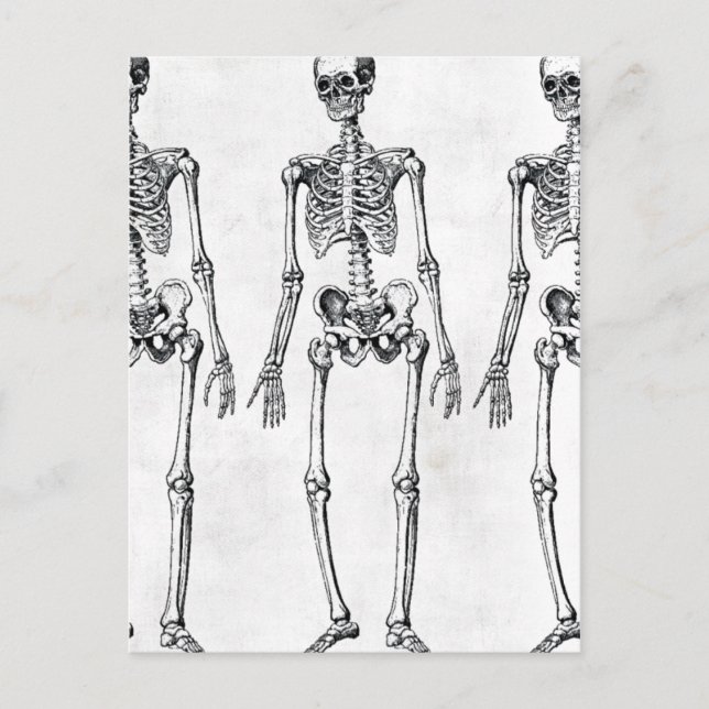 Skeletons Postcard (Front)