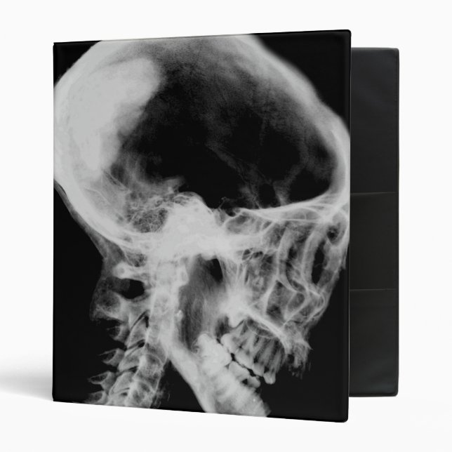 Skull X-Ray Black & White Binder (Front/Inside)