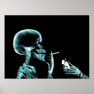 smoking x-ray poster