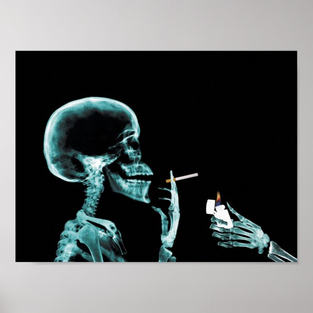 smoking x-ray poster (Front)