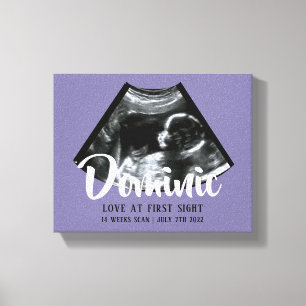 Sonogram Keepsake Baby Ultrasound Canvas Print