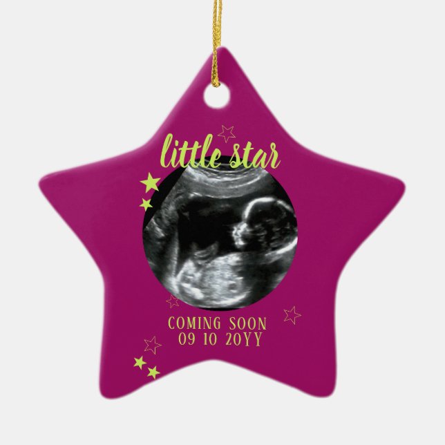 Sonogram Keepsake Baby Ultrasound Ceramic Ornament (Front)