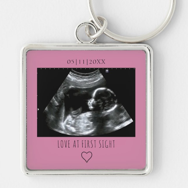 Sonogram Picture Photo Gift Baby Ultrasound Pink Keychain (Front)