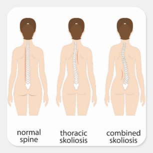 Spinal deformity square sticker