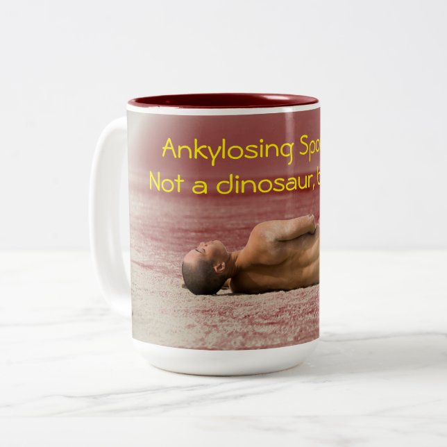Spondylarthrite ankylosante, pas une tasse de (Devant gauche)
