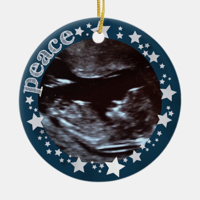 Stars & Joy! Sonogram First Christmas Ornament (Front)
