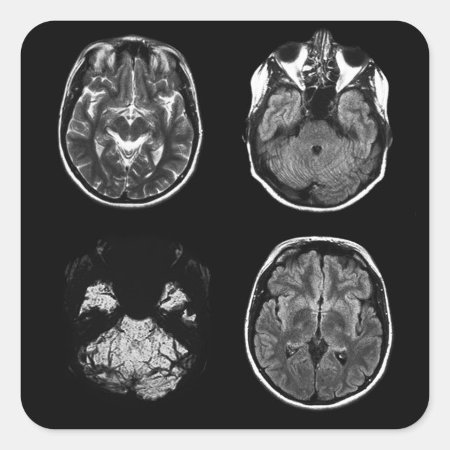 Sticker Carré Analyse IRM du cerveau (Devant)