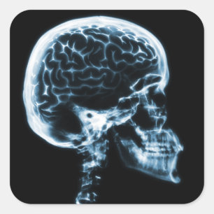 STICKER CARRÉ CERVEAU JUMEAU X-RAY - BLEU