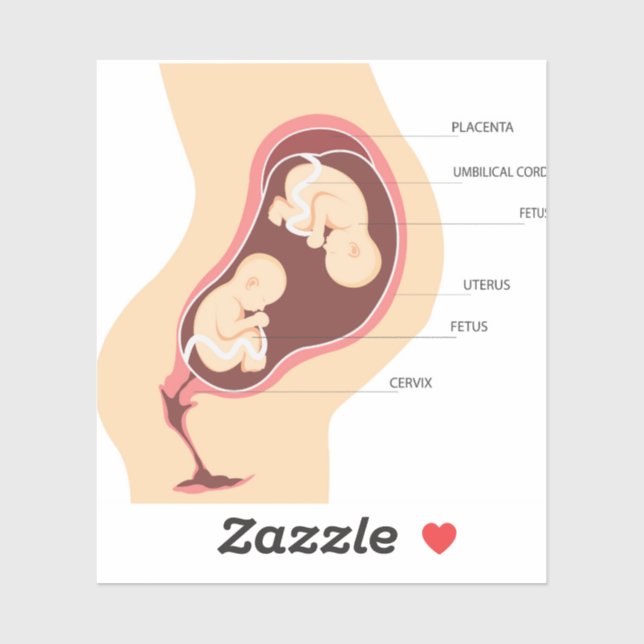 Sticker Grossesse jumelle dizygotique (Feuille)