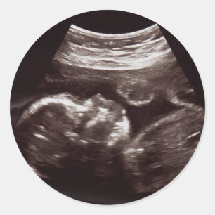 Sticker Rond Baby shower photo Ultrasound Merci