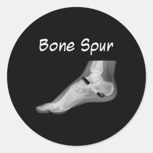 Sticker Rond Stylo à encre Trump Bone Spur Drôle Anti Trump 