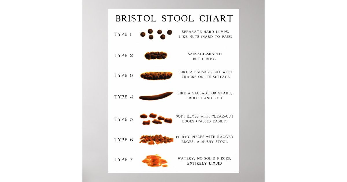 Stool Chart Poster Zazzle