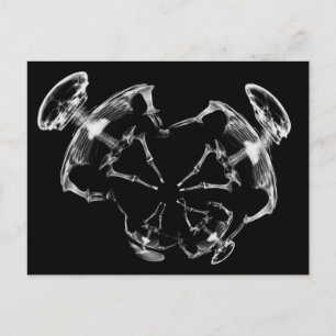 Stretched X-Ray Skeleton Family B&W Postcard