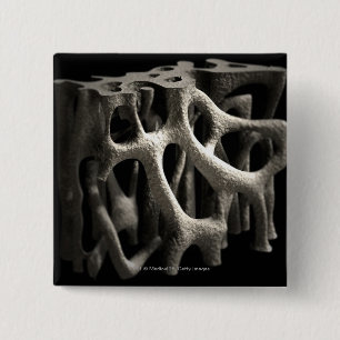 Structure of a bone with osteoporosis 2 inch square button