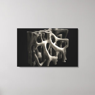 Structure of a bone with osteoporosis canvas print