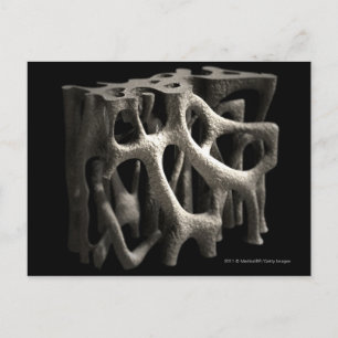 Structure of a bone with osteoporosis postcard