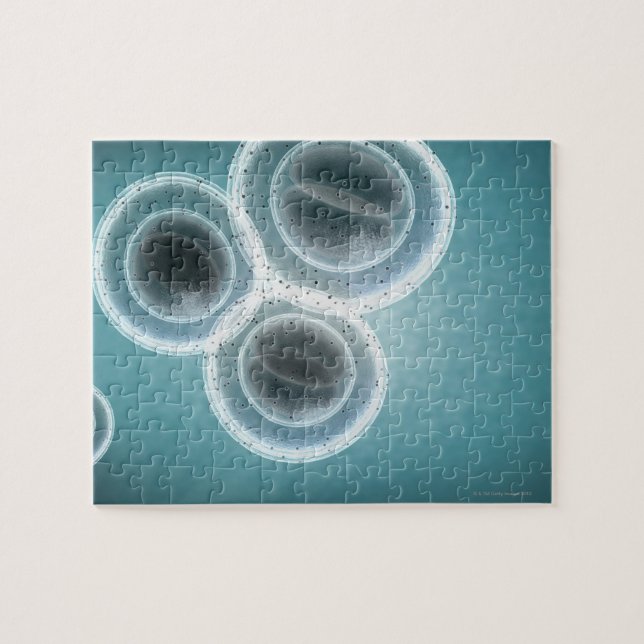 Structure of MRSA Jigsaw Puzzle (Horizontal)