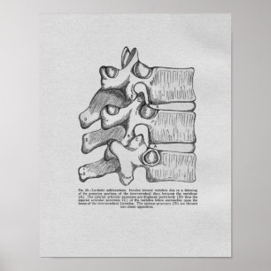 Subluxe chiropratique Impression Vintage