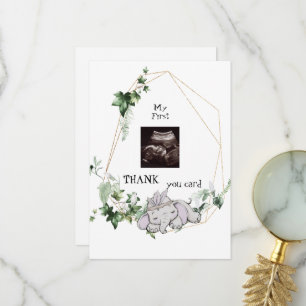 Super Ultrasound Merci Baby Girl Viewpoint 