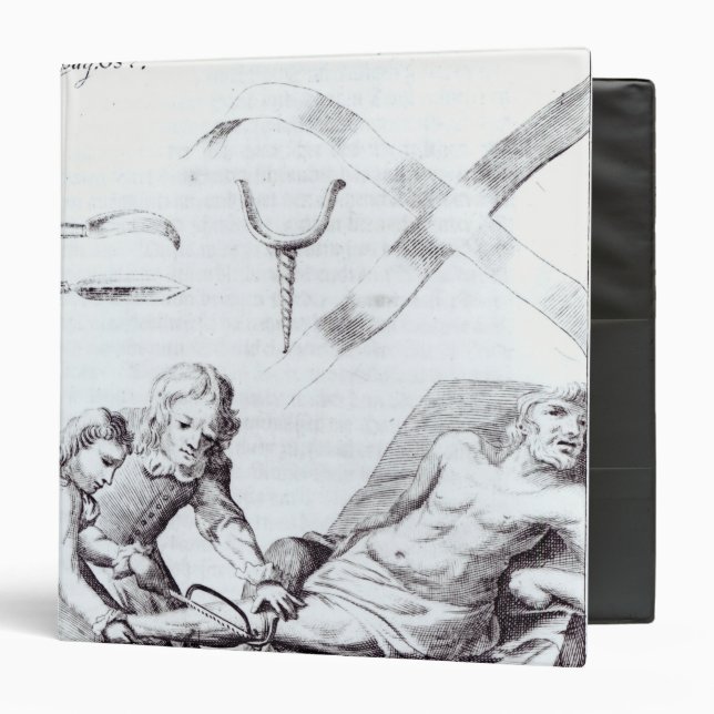 Surgical operation to amputate a leg binder (Front/Inside)