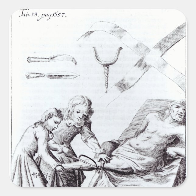 Surgical operation to amputate a leg square sticker (Front)