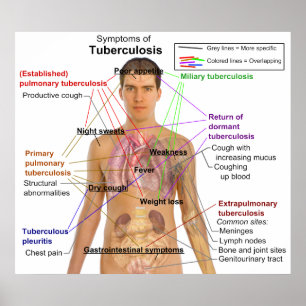 Symptom Chart of Tuberculosis in Humans