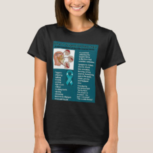 T-shirt Ce qui est chemise de névralgie faciale…
