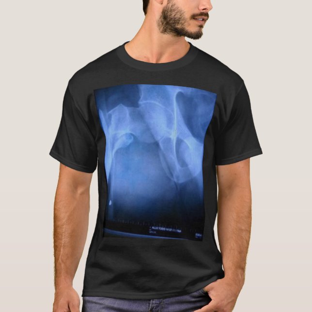 T-shirt fémur cassé (Devant)