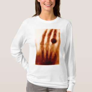 T-shirt Le premier rayon X, 1901, photographie