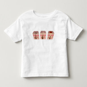 T-shirt Pour Les Tous Petits Vue de ce qui cause l'acné