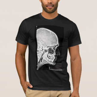 T-shirt principal de rayon X