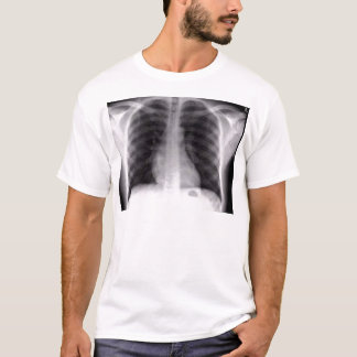 T-shirt radiographie de la poitrine
