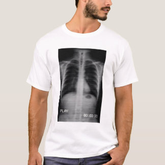 T-shirt “Retro VHS X-Ray” Radiographie thoracique vintage