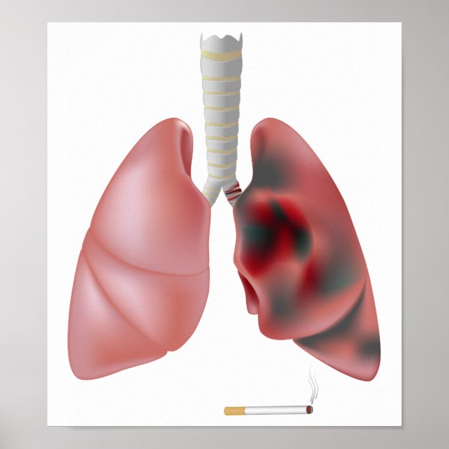 Tabagisme et cancer du poumon Poster (Devant)