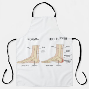 Tablier La difformité de Haglund