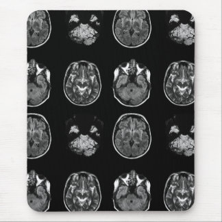Tapis De Souris Analyse IRM du cerveau