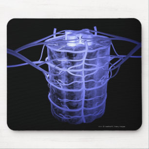 Tapis De Souris Artères entourant une partie de la colonne