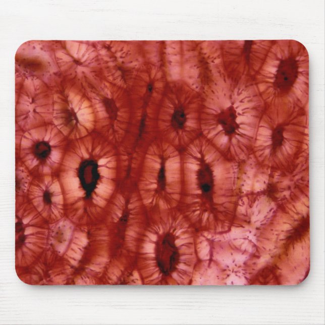 Tapis De Souris Cellules de Sclerenchyma d'un puits de cerise (Devant)