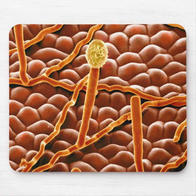 Tapis De Souris Champignon de rouille pulvérulente sur la (Devant)