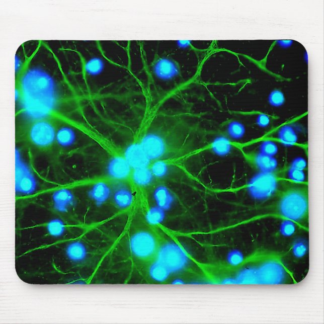 Tapis De Souris Les Astrocytes sont des cellules globulaires en fo (Devant)
