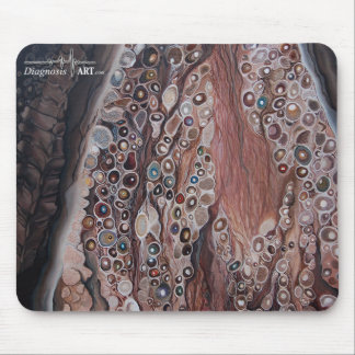 Tapis De Souris "Sensation : Ganglion de racine dorsale "