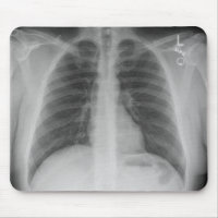 X-Ray Mousepad