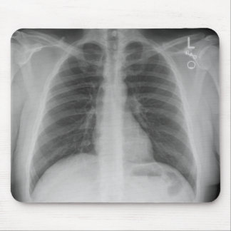 Tapis De Souris X-Ray Mousepad