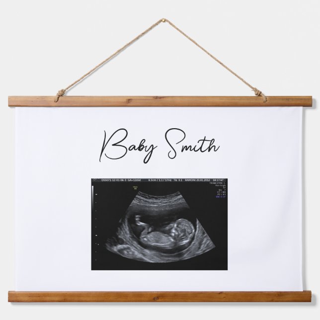 Tapisserie Suspendue Sonogramme de bébé personnalisé Ultrasons Bois hac (Devant)