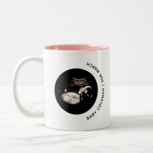 Tasse 2 Couleurs Faire-part de grossesse Sonogramme de bébé