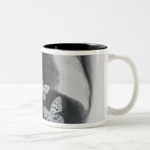 Tasse 2 Couleurs Rayon X des papillons dans l'estomac