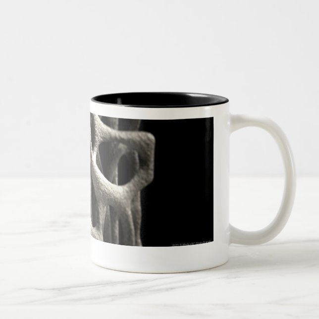 Tasse 2 Couleurs Structure d'un os avec l'ostéoporose (Droit)