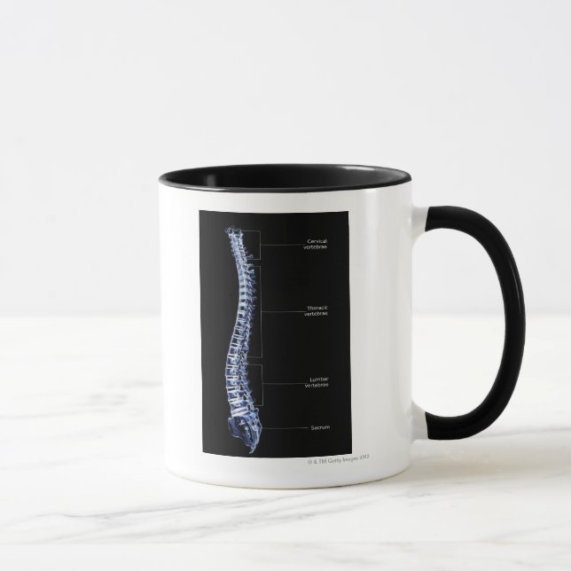 Tasse Colonne vertébrale 4 (Droite)