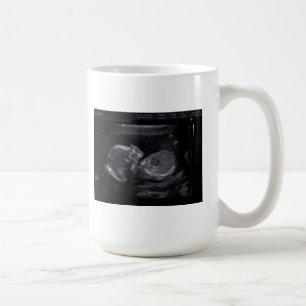 Tasse customisée d'ultrason