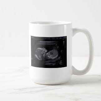 Tasse customisée d'ultrason